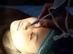 做鼻子过程视频,从术前准备到术后恢复